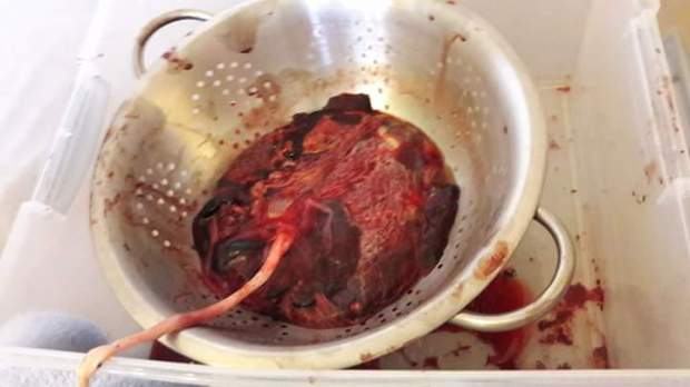 FB_IMG_1502664195436