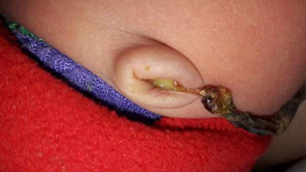 FB_IMG_1502664212888